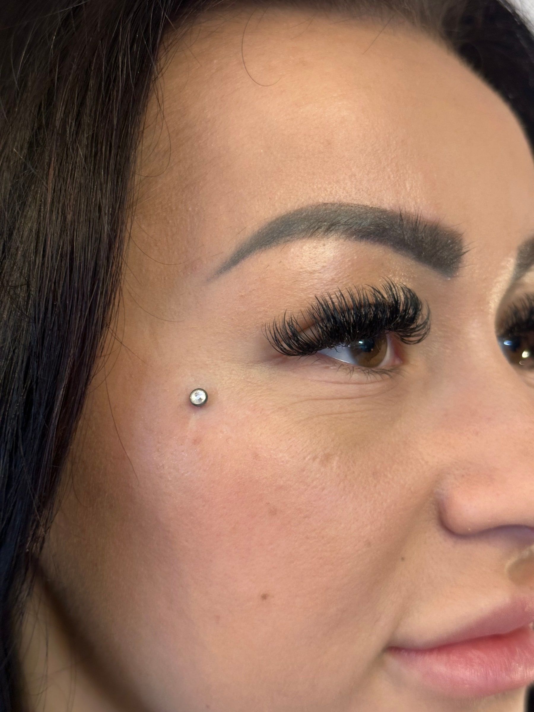 Microdermal