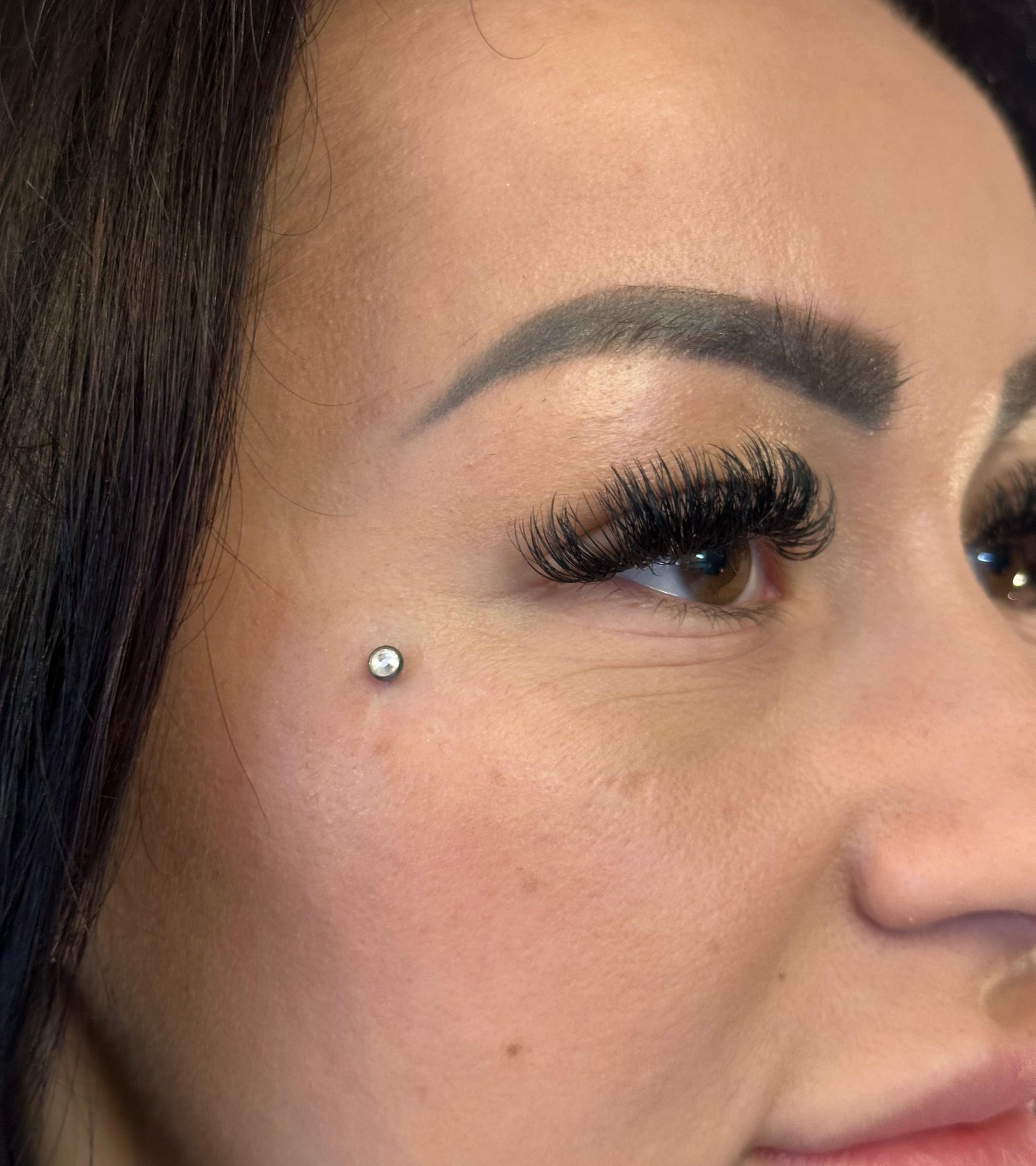 Microdermal