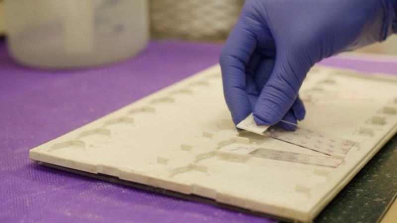 Close-up of student handling histology slides in hospital laboratory — School District of Philadelphia healthcare internship program