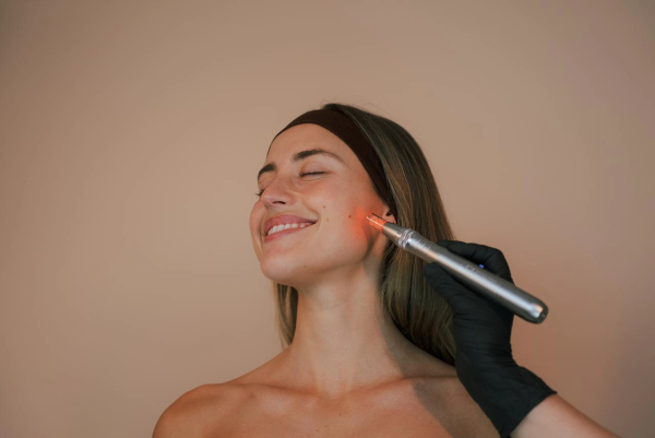 Nanoneedling Facial