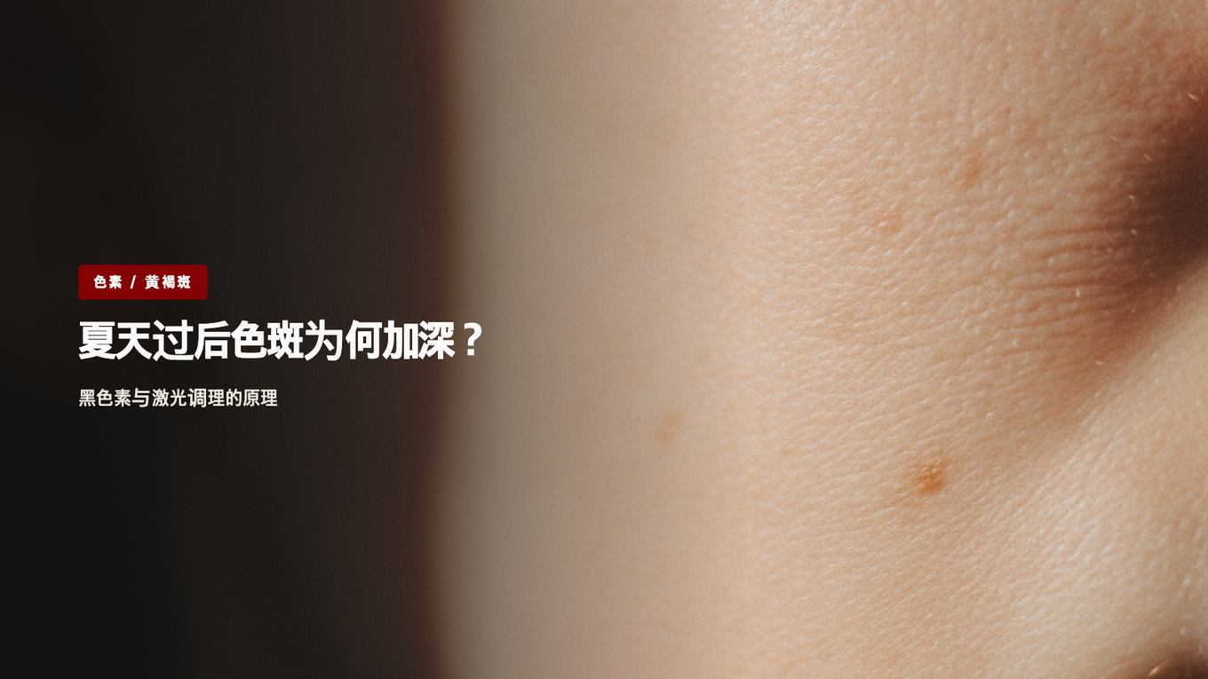 夏季紫外线与黑色素，激光调理原理的宁静标题图片