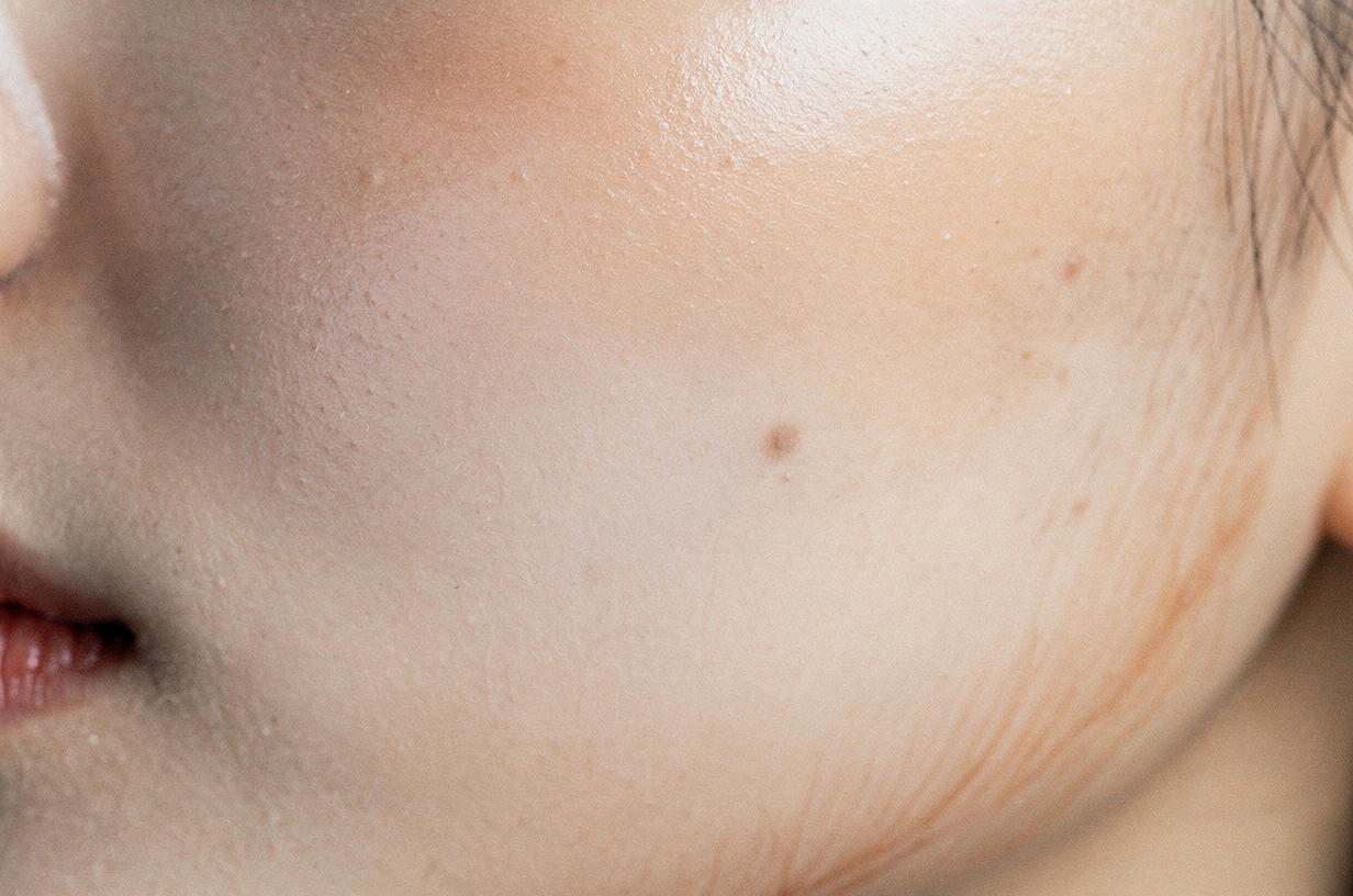 Subtle close-up of healthy skin with a natural glow