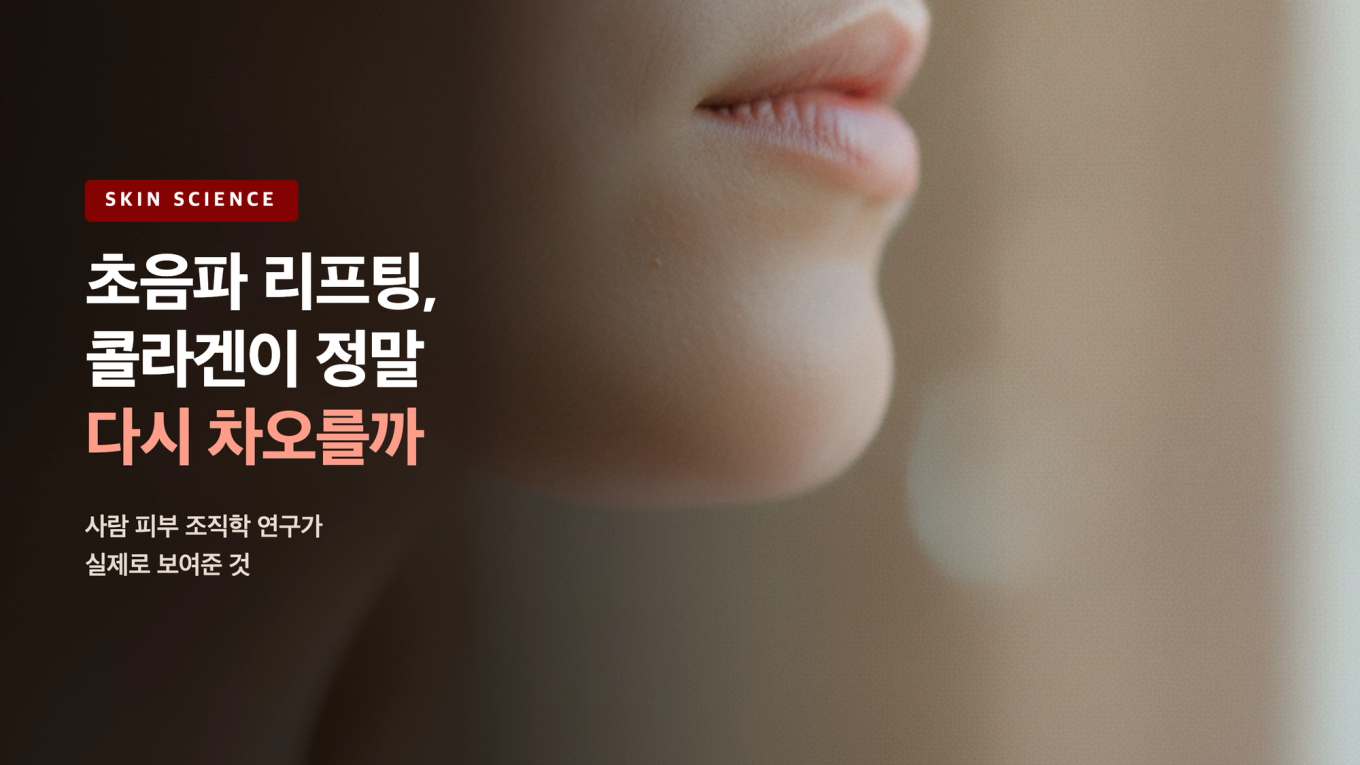 초음파 리프팅, 콜라겐이 정말 다시 차오를까 / 사람 피부 조직학 연구가 실제로 보여준 것