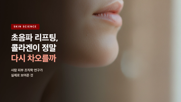 초음파 리프팅, 콜라겐이 정말 다시 차오를까 - 조직학 연구가 보여준 것