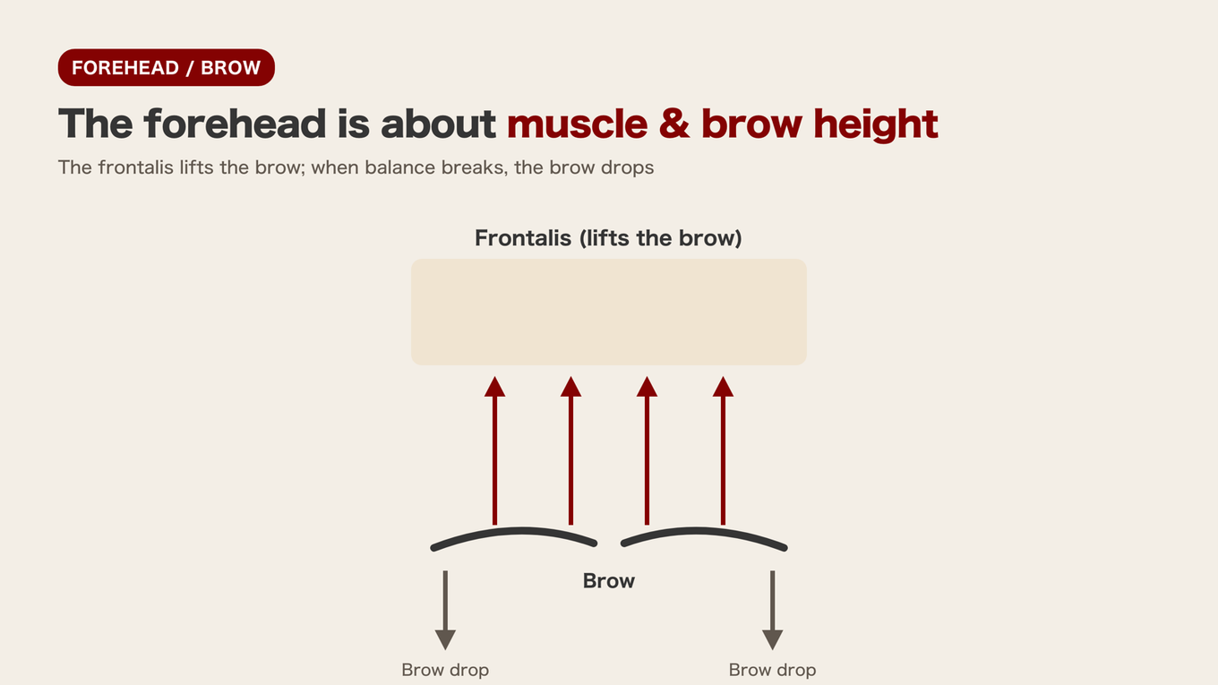 Shows the force and balance of the frontalis muscle lifting eyebrows and counteracting the downward pull of sagging eyebrows