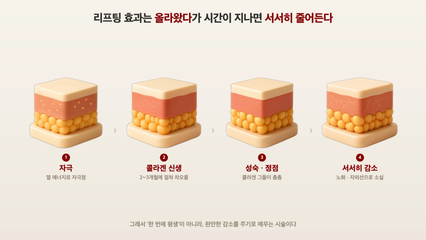 리프팅 자극 후 콜라겐이 신생/성숙되었다가 노화로 서서히 줄어드는 과정을 피부 단면 3D 모형 4단계로 보여주는 도식