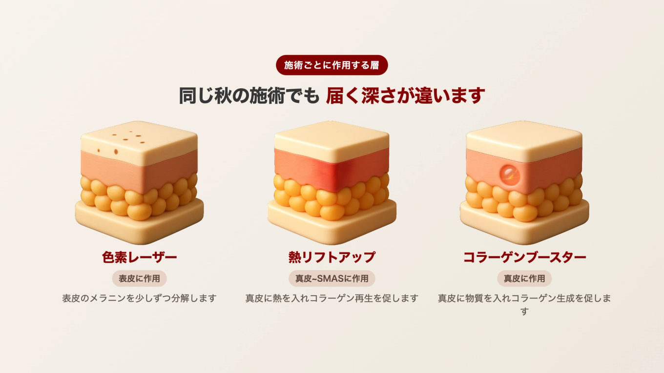 色素は表皮、熱リフトアップは真皮とSMAS、コラーゲンブースターは真皮に物質を入れてそれぞれ異なる深さに作用する