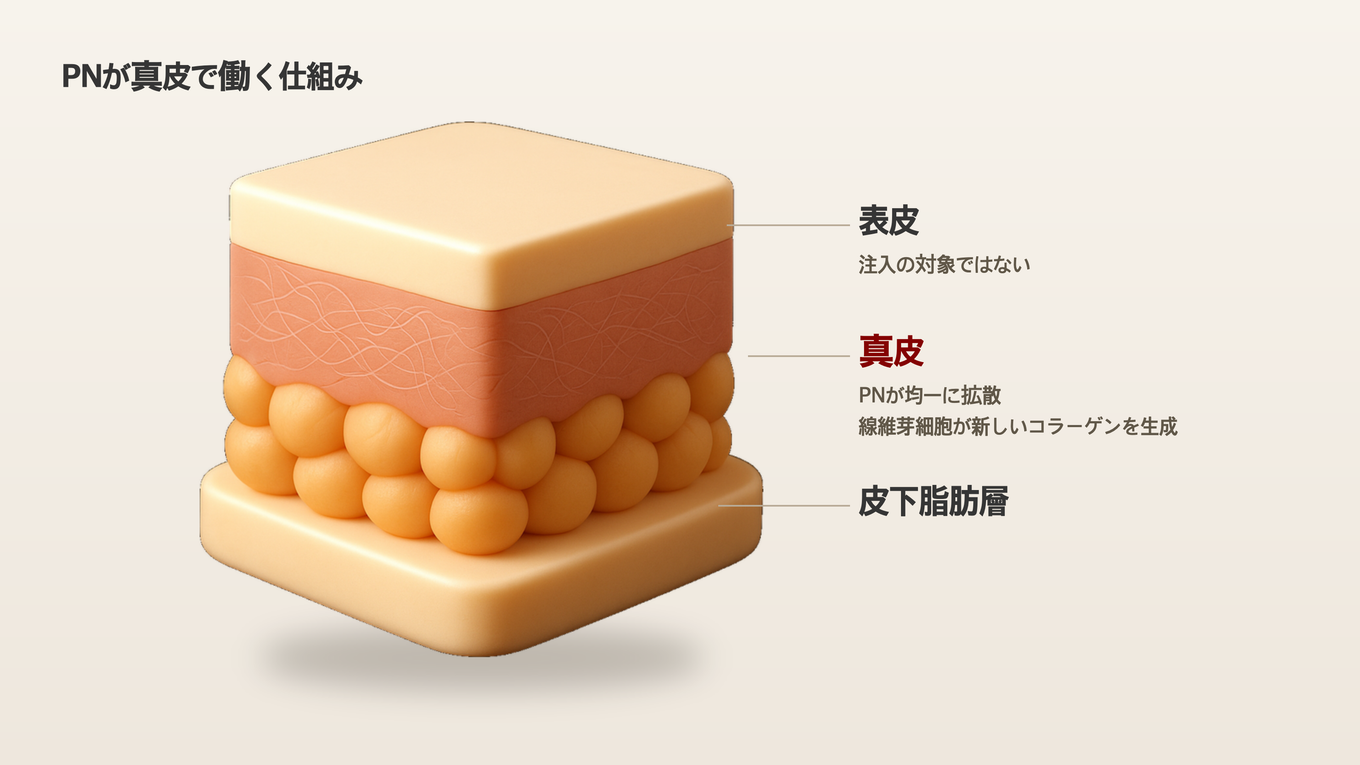表皮と脂肪層の間の真皮にポリヌクレオチドが広がり、線維芽細胞を刺激して新しいコラーゲンが作られる