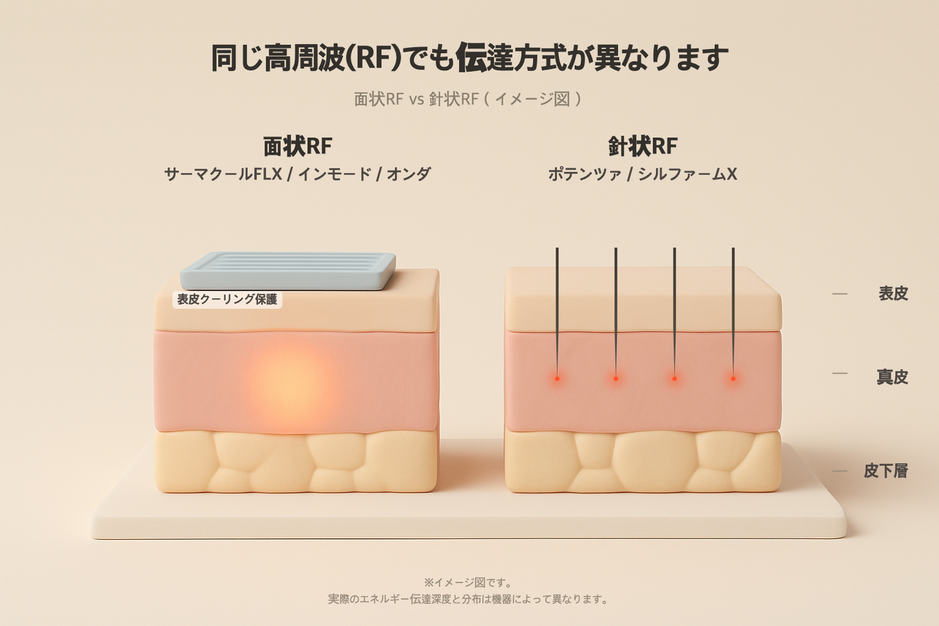 同じ高周波でも、面で温めるサーマクール系と針で刺し入れるニードル系では伝え方が異なる