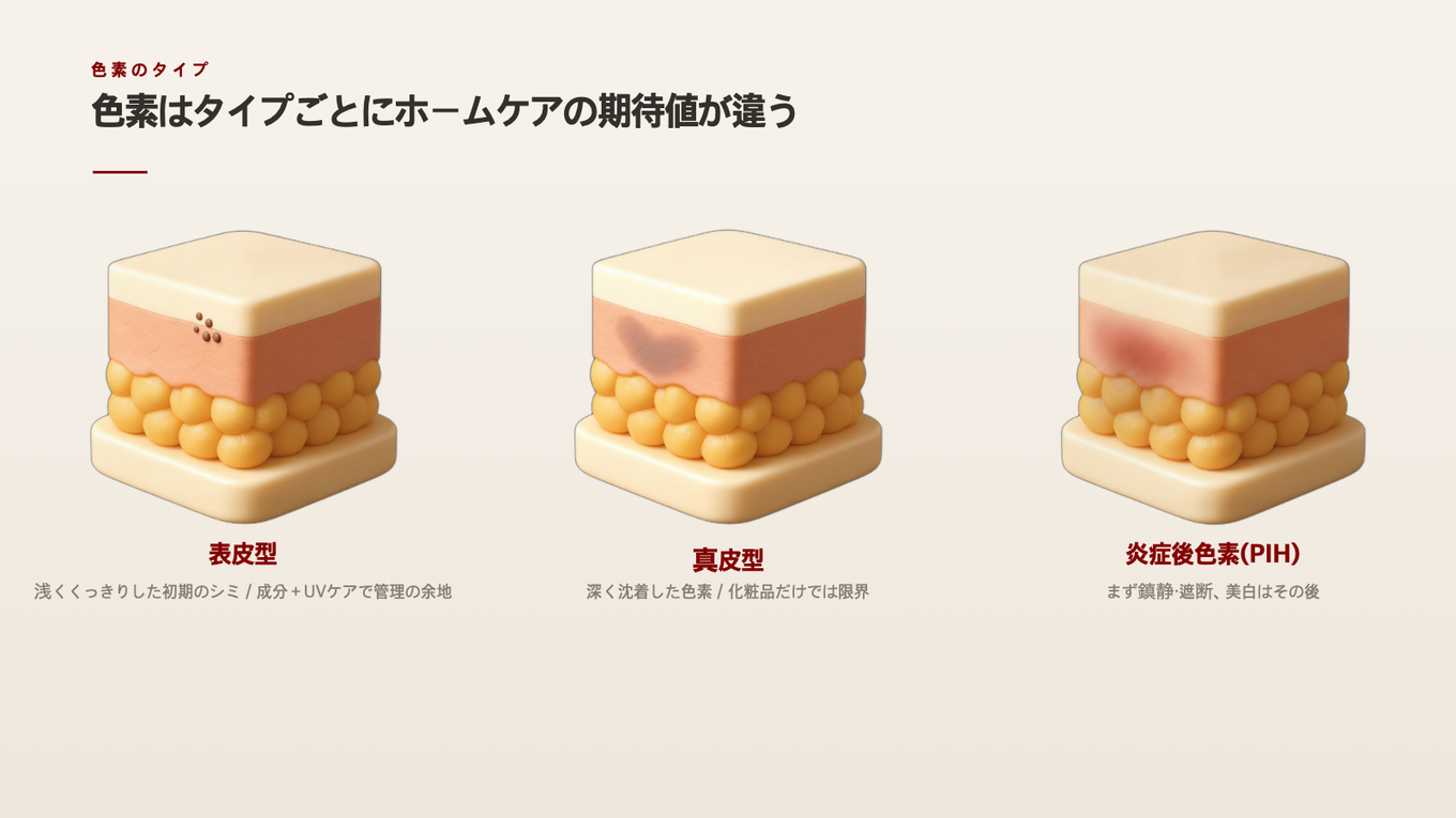 表皮型は浅い茶色の点、真皮型は深く広がった色素、炎症後色素は赤みとともに現れ、タイプごとにホームケアの期待値が異なります