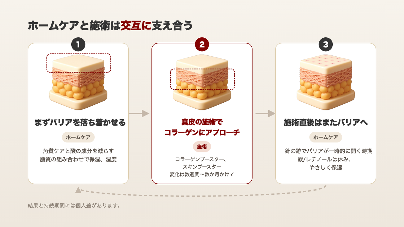 まずバリアを落ち着かせ、真皮の施術でコラーゲンにアプローチし、施術直後はまたバリアを守る