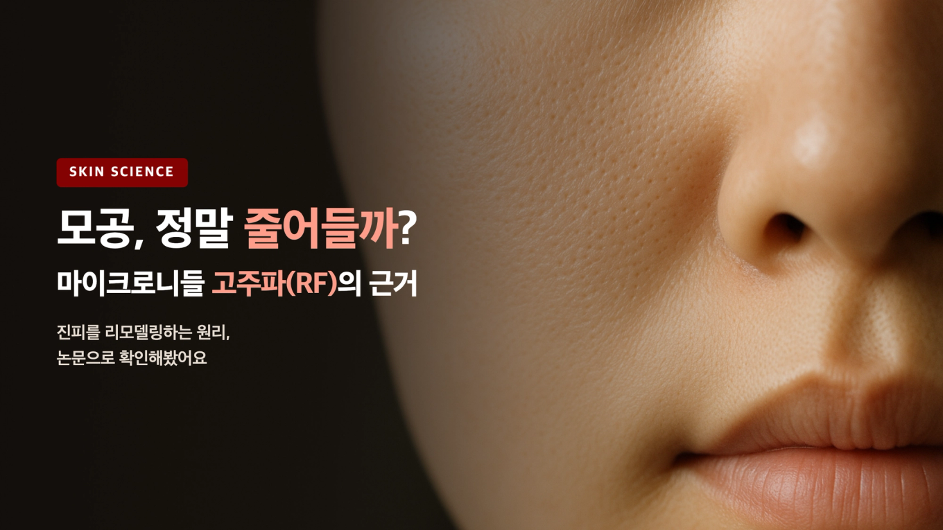모공, 정말 줄어들까 - 마이크로니들 고주파(RF)가 진피를 리모델링한다는 근거를 논문으로 확인한다