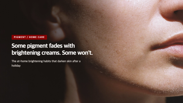 Melasma Darker After Vacation? Why Brightening Creams Only Reach Certain Pigment