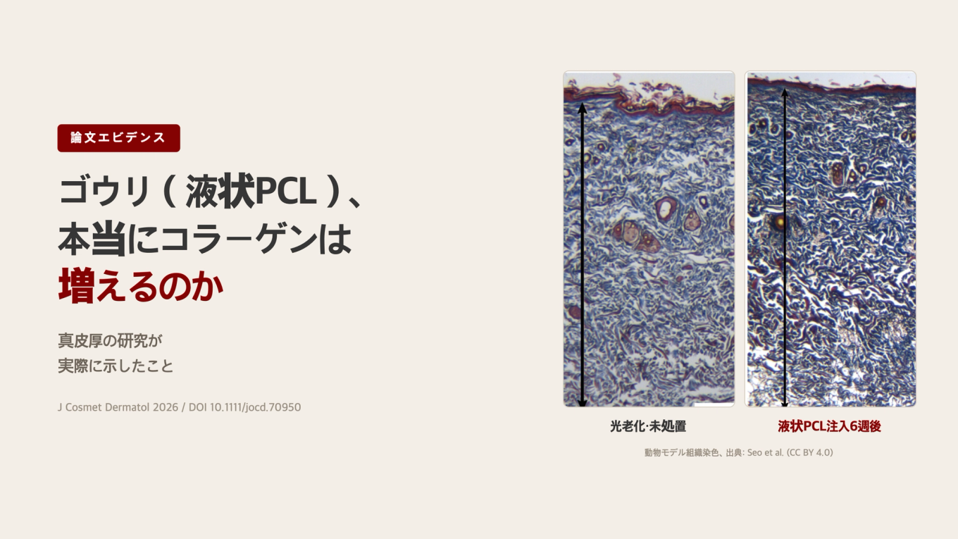ゴウリ（液状PCL）で本当にコラーゲンは増えるのか / 真皮厚の研究が示したこと