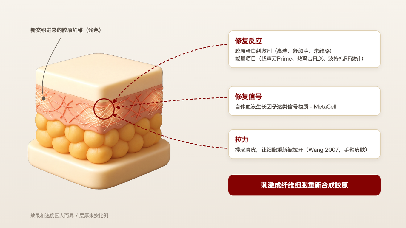 在稀疏断裂的胶原之间刺激成纤维细胞,让新的胶原纤维交织进来