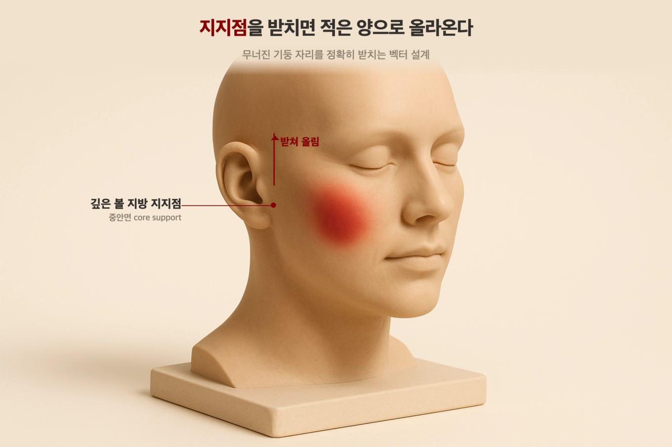 얼굴 볼륨을 받치는 핵심 지지점을 정확히 받쳐주면 적은 양으로도 얼굴 전체가 올라온다는 것을 보여주는 지지점 개념 3D 모형 도식