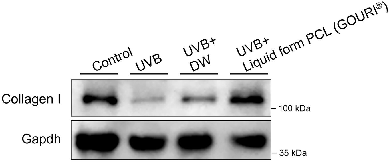 Type 1 collagen protein immunoblot - bands faded by photoaging turn darker again in the liquid PCL group