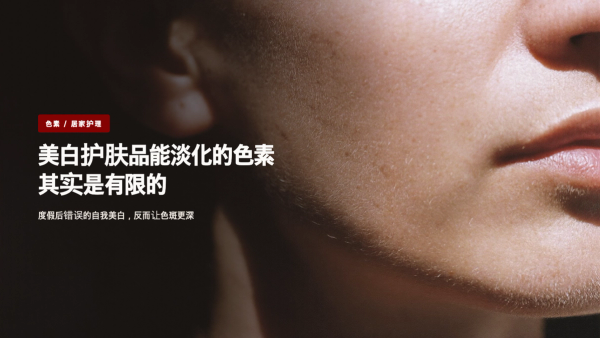 度假回来色斑变深了?美白护肤品能淡化的色素其实是有限的