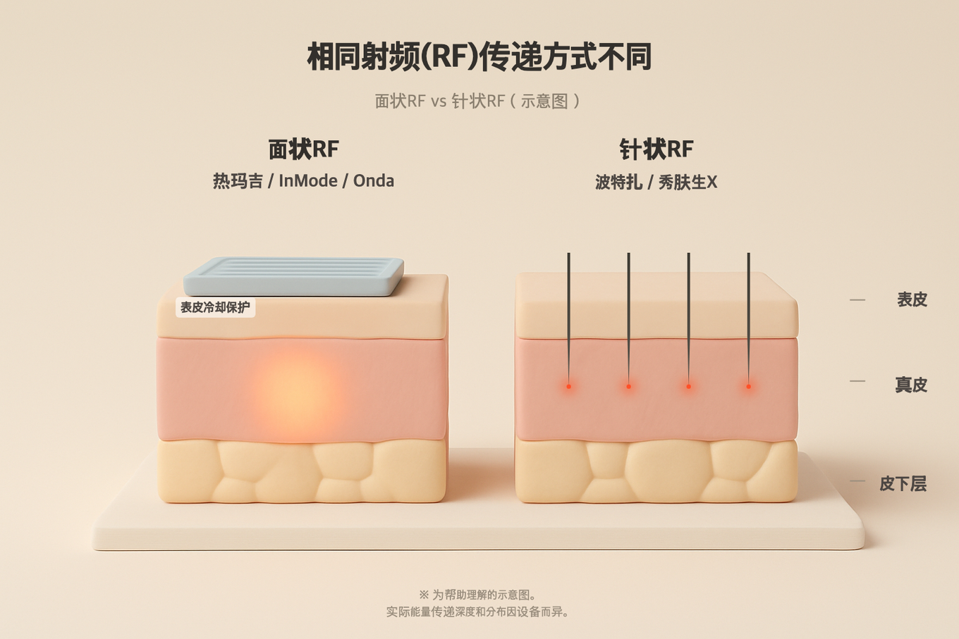 同样是射频，以面状加热的热玛吉类与用微针导入的针型，传递方式并不相同