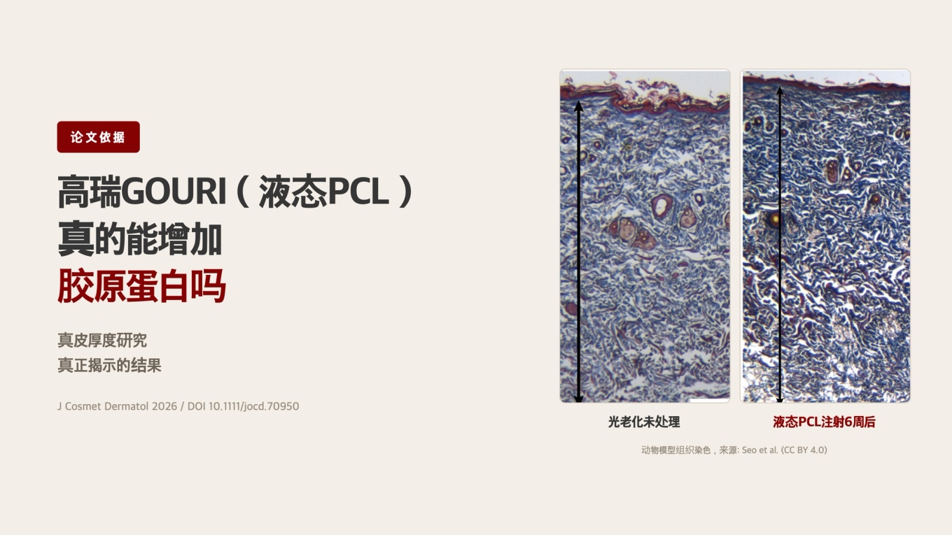 高瑞GOURI（液态PCL）真的能增加胶原蛋白吗 / 真皮厚度研究揭示的结果