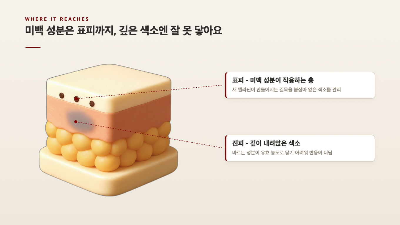바르는 미백 성분은 표피에는 닿지만 깊은 진피 색소까지는 유효하게 내려가지 못한다