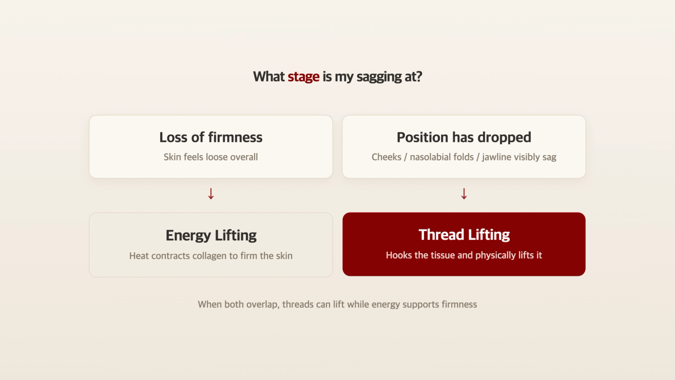 Decision axis graphic showing whether thread lifting or energy lifting is more suitable based on the stage of sagging