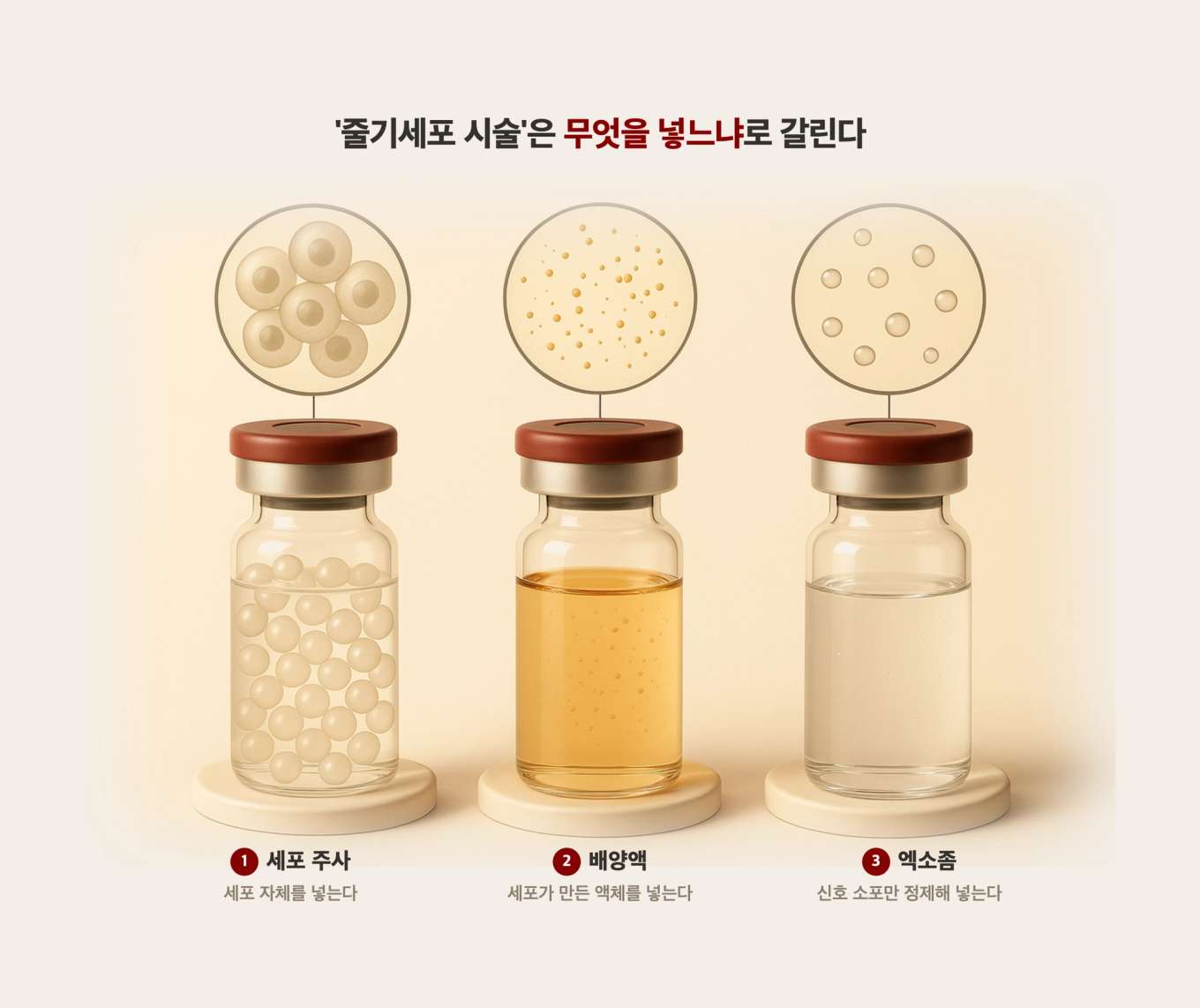 줄기세포 시술이 세포 주사와 배양액과 엑소좀 세 갈래로 나뉘는 원리를 담은 사실적 3D 모형 도식