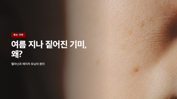 여름 지나 짙어진 기미, 왜 그럴까 - 색소와 레이저 토닝의 원리