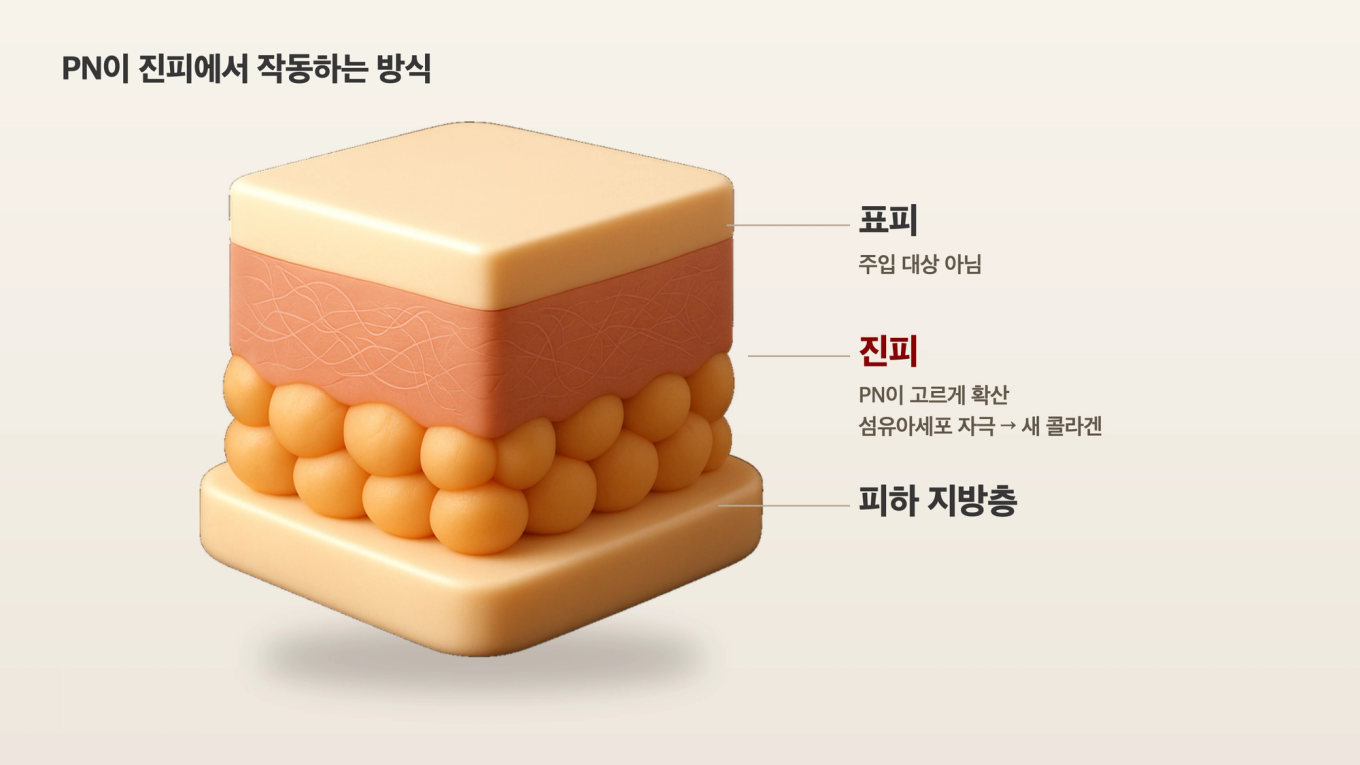 표피와 지방층 사이의 진피에 폴리뉴클레오티드가 퍼져 섬유아세포를 자극하고 새 콜라겐이 만들어지는 층