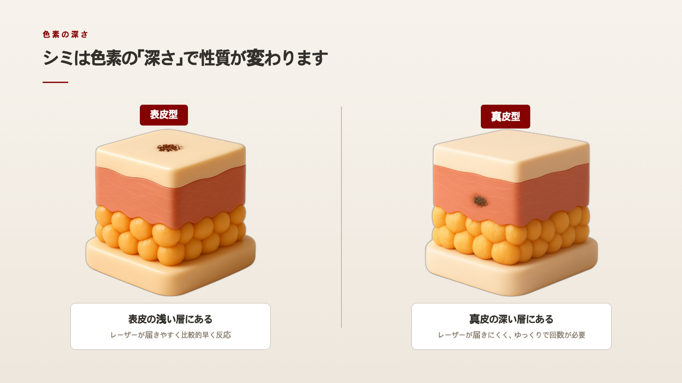肌の表皮と真皮の断面で、色素が浅く/深く位置する様子を示す断面図