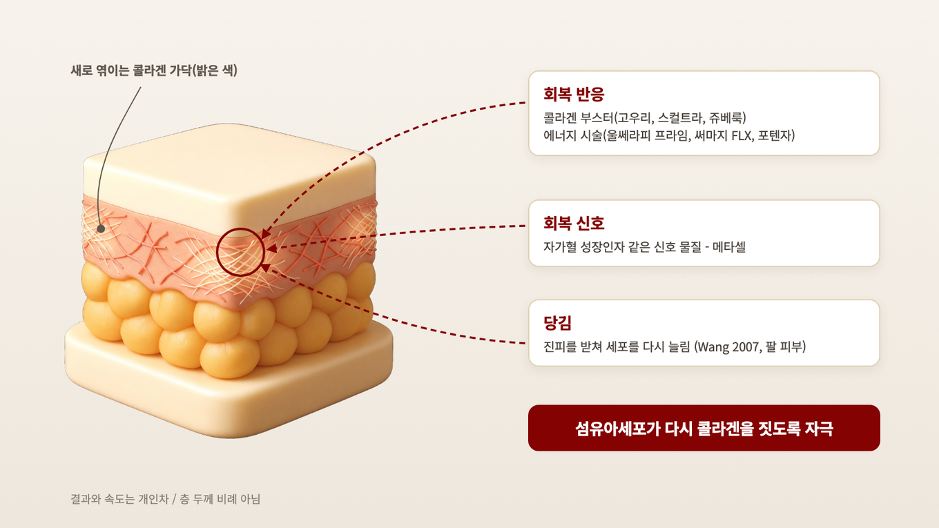 성글고 끊긴 콜라겐 사이로 새 콜라겐 가닥이 엮이도록 섬유아세포를 자극한다