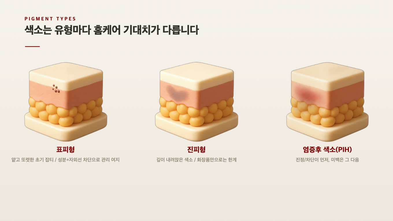 표피형은 얕은 갈색 점, 진피형은 깊이 번진 색소, 염증후 색소는 홍조와 함께 나타나 유형마다 홈케어 기대치가 다르다