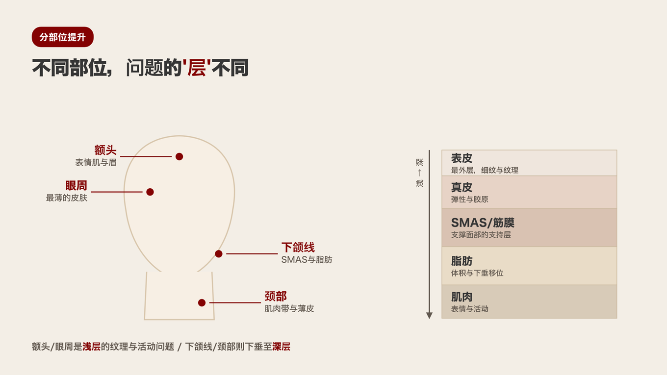额头和眼周是浅层问题,下颌线和颈部是SMAS等深层支撑层下垂的问题,因此每个部位问题的皮肤层次不同