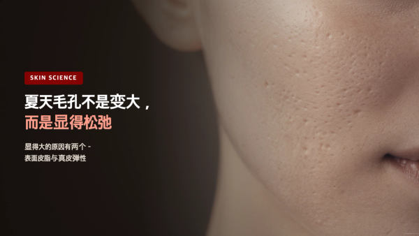 夏天毛孔粗大不是变大,而是显得松弛 - 皮脂与弹性两大原因