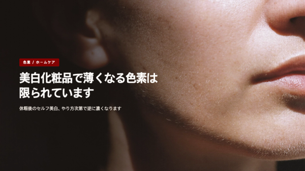 休暇明けにシミが濃くなったら - 美白化粧品で薄くなる色素は限られています【韓国・明洞】