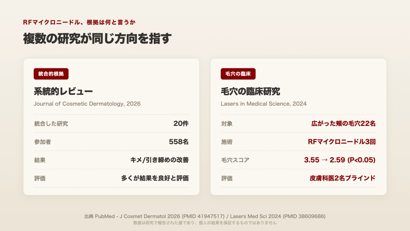 RFマイクロニードルは、20件を統合したレビューと、毛穴だけを見た臨床研究の両方で、肌と毛穴の改善を報告した