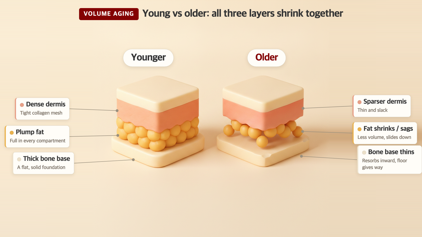 In youth, facial fat is plump, the support is thick, and the dermis is dense, but with age, fat depletes and sags, support thins, and the dermis becomes sparse