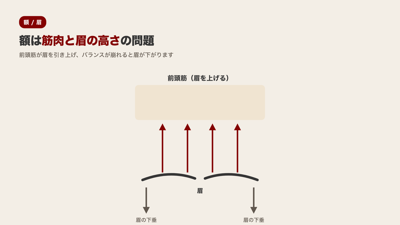 前頭筋が眉を上に引き上げる力とバランスが崩れ、眉が下に下がる力を同時に示す