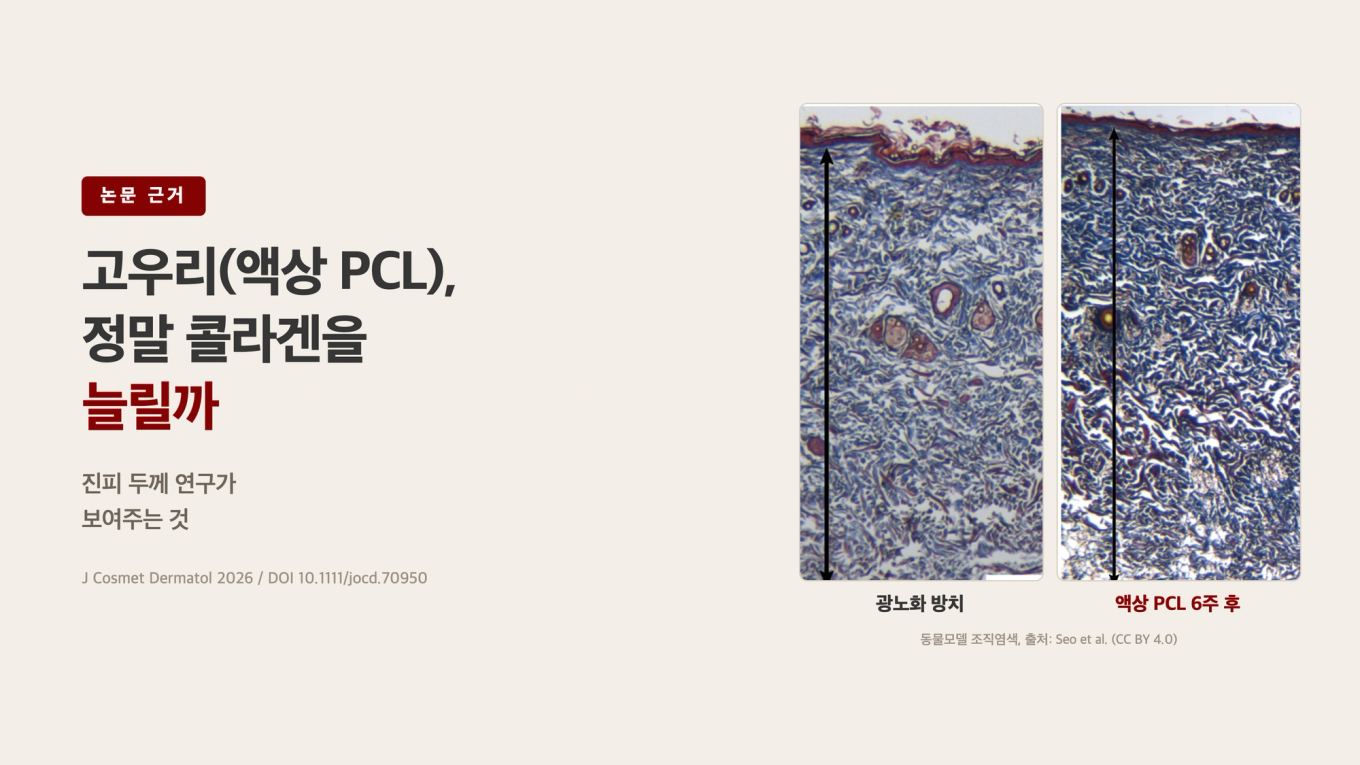 고우리(액상 PCL), 정말 콜라겐을 늘릴까 / 진피 두께 연구가 보여주는 것