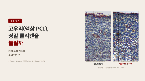 고우리(액상 PCL), 정말 콜라겐을 늘릴까 - 진피 두께 연구가 보여주는 것
