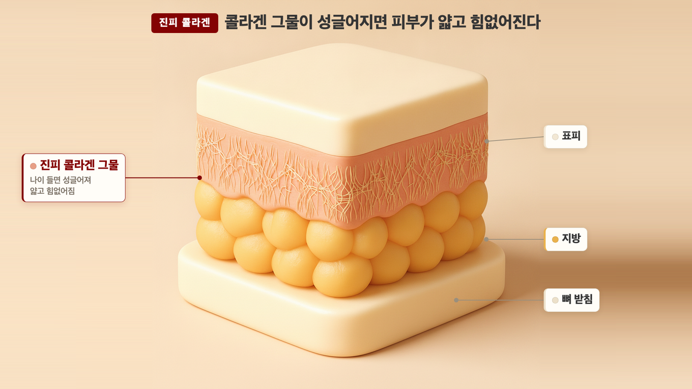 진피의 콜라겐 그물이 젊을 때는 촘촘하지만 나이 들면 성글어져 얇고 힘이 없어진다