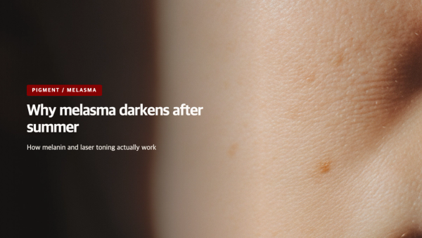 Why Melasma Darkens After Summer - The Science of Pigment and Laser Toning