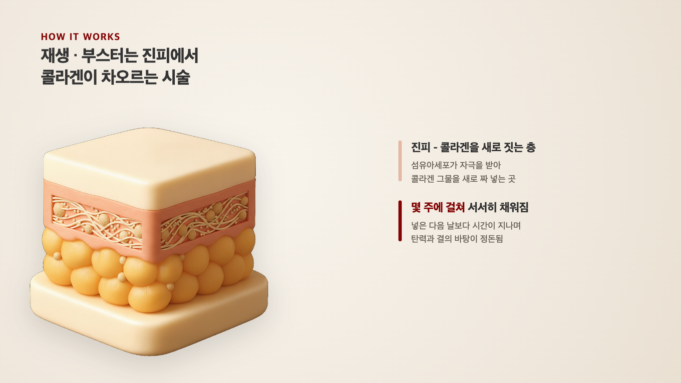 진피의 섬유아세포가 시간을 두고 콜라겐을 새로 지어 결과 탄력의 바탕이 채워진다