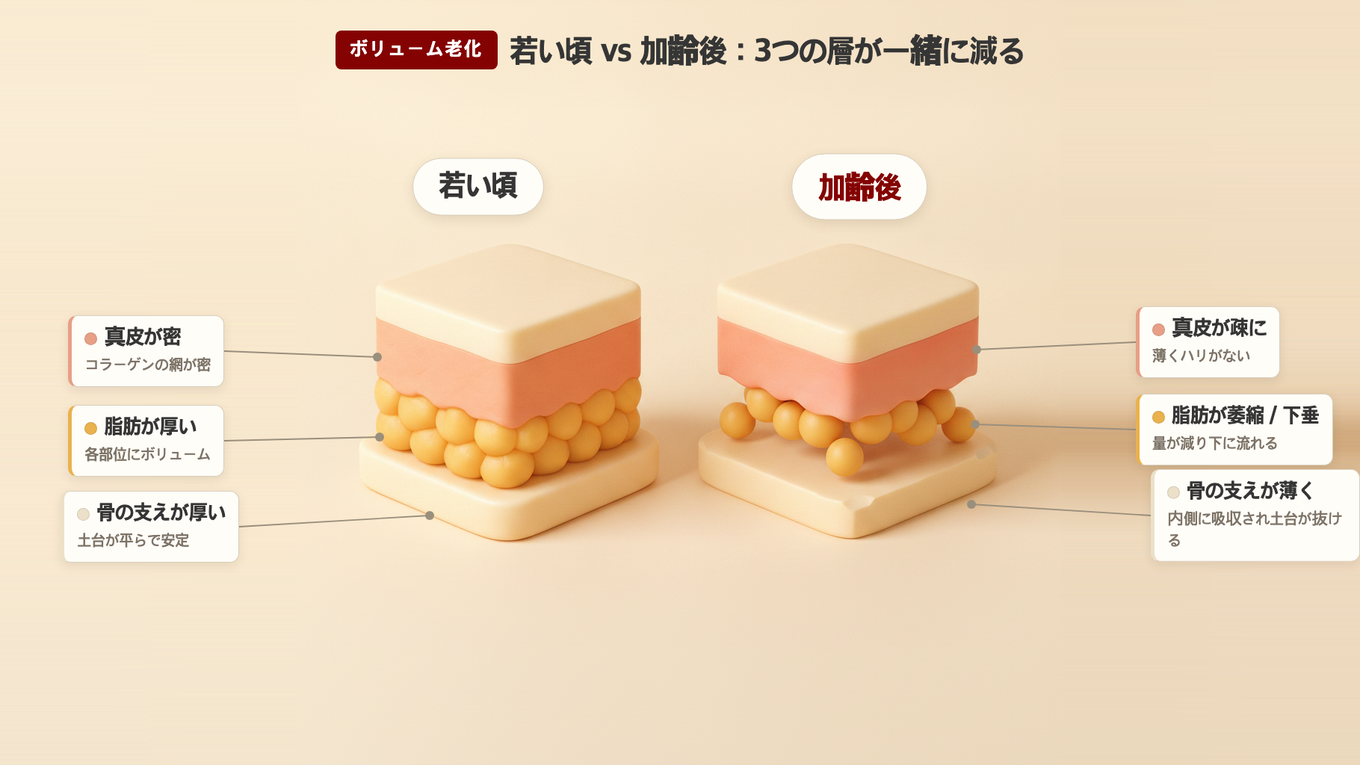 若い顔は脂肪が厚く、支えがしっかりしており、真皮が密ですが、年を取ると脂肪が縮小・下降し支えが薄くなり、真皮が緩くなる
