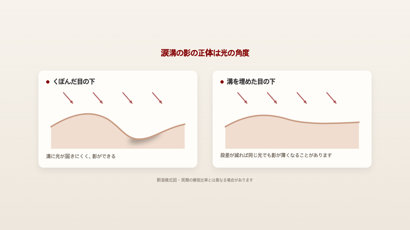 涙溝の影はくぼんだ溝に光が届かないことでできる - 溝の段差が緩和されれば同じ光でも影が薄くなる可能性がある