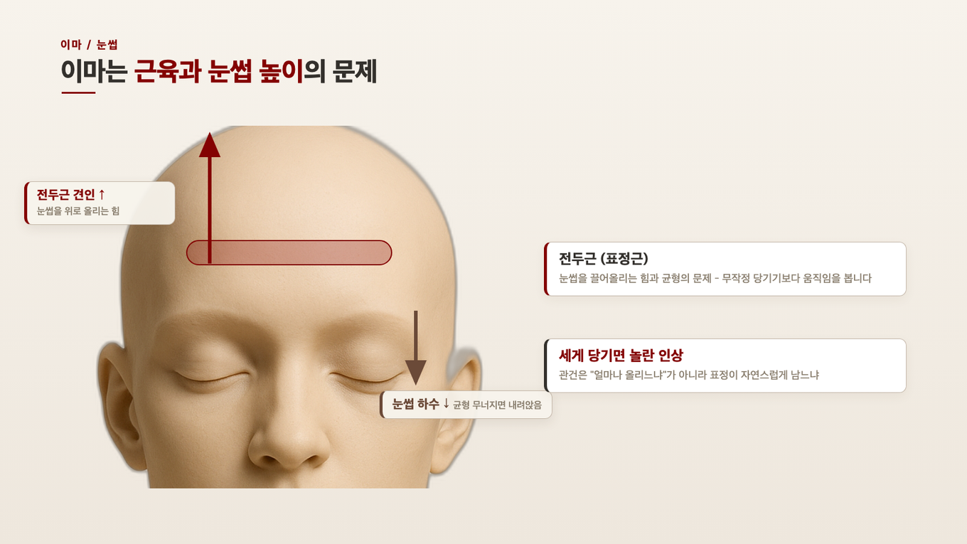 전두근이 눈썹을 위로 끌어올리는 힘과 균형이 무너져 눈썹이 아래로 내려앉는 힘을 함께 보여준다