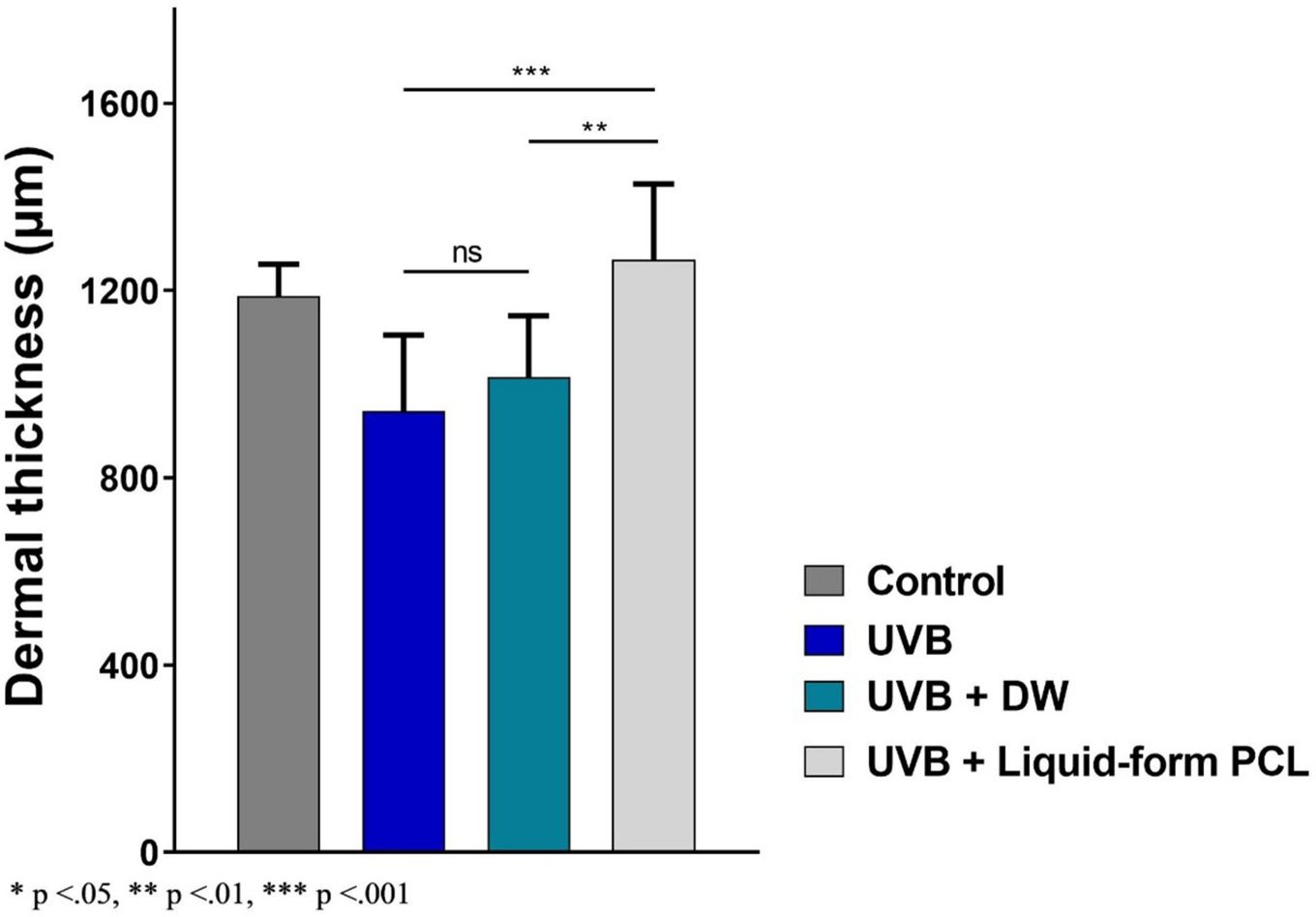 Graph from the paper comparing dermal thickness across the four groups - the liquid PCL group is significantly thicker than the untreated photoaged and distilled-water groups