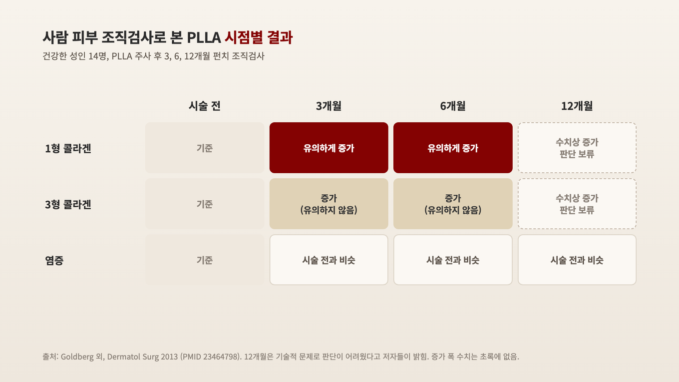 건강한 성인 14명의 조직검사에서 1형 콜라겐은 3개월과 6개월째 유의하게 늘었고, 12개월은 판단이 보류됐으며, 염증은 모든 시점에서 시술 전과 비슷했다