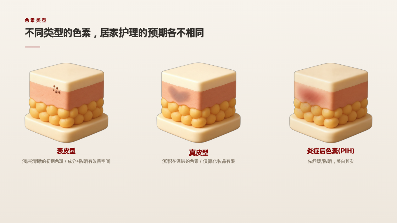 表皮型是浅褐色的斑点，真皮型是往深处晕开的色素，炎症后色素还伴着泛红 - 每种类型对居家护理的预期都不同