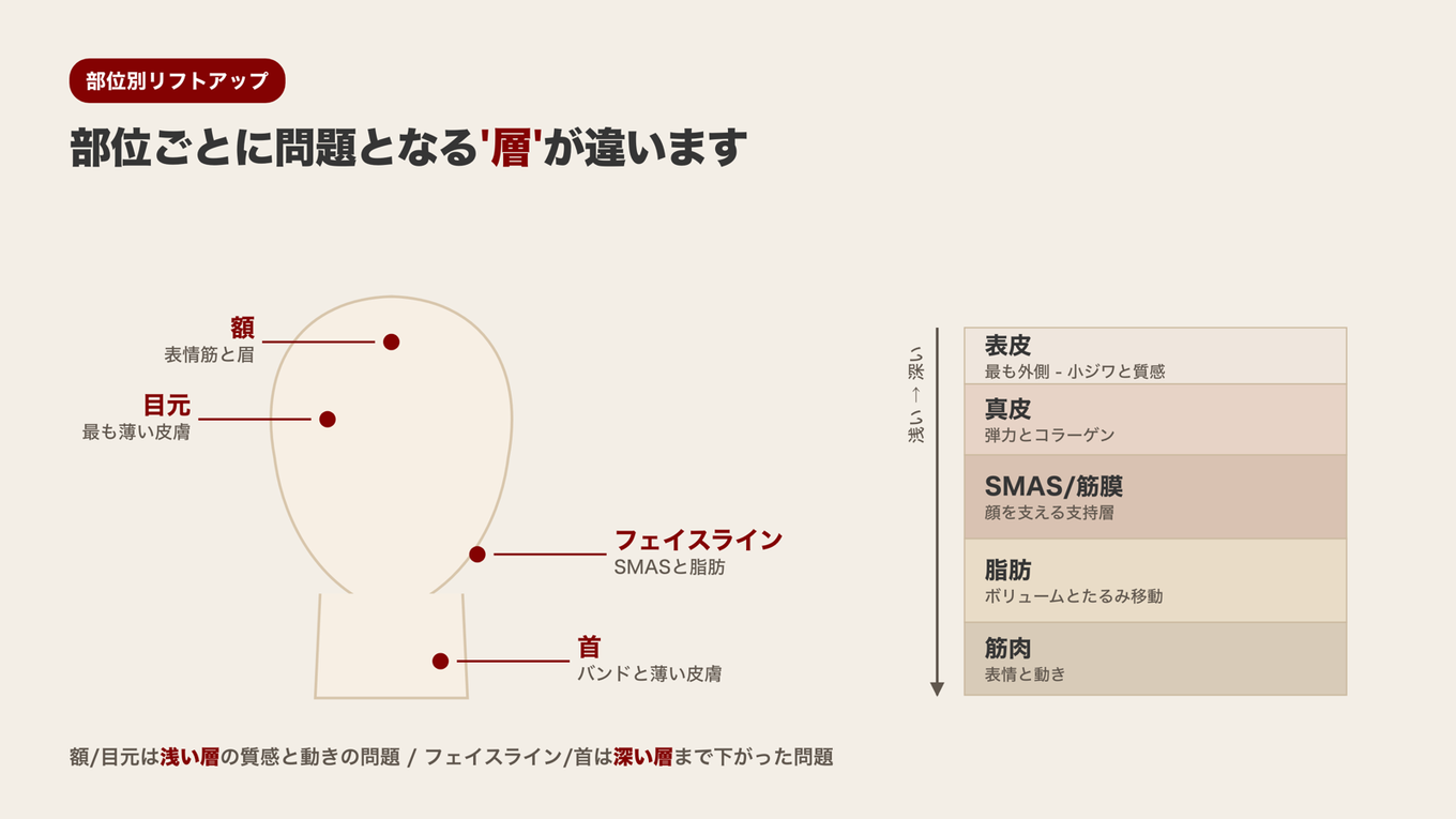 額と目元は浅い層の問題、フェイスラインと首はSMASのような深い支持層まで下がる問題で部位ごとに問題となる皮膚の層が異なる